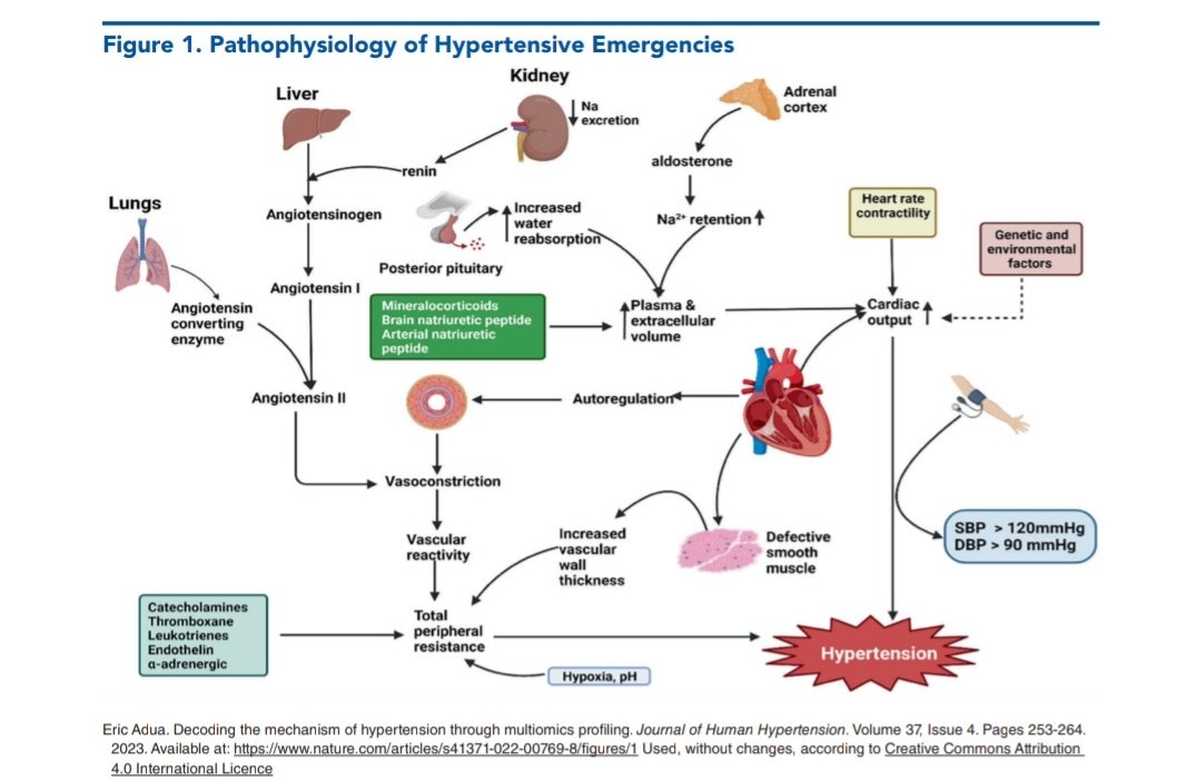 SOMELaguna's tweet photo. Guias y Mejores Prácticas Recomendadas en Emergencias Hipertensivas ‼️🫀🤔

🔰📚Emergency Medicine Practice

Artículo completo 🆓️ 👇🏼✅ 
https://t.co/RI53cNdEFq https://t.co/14wNLhUO2G
