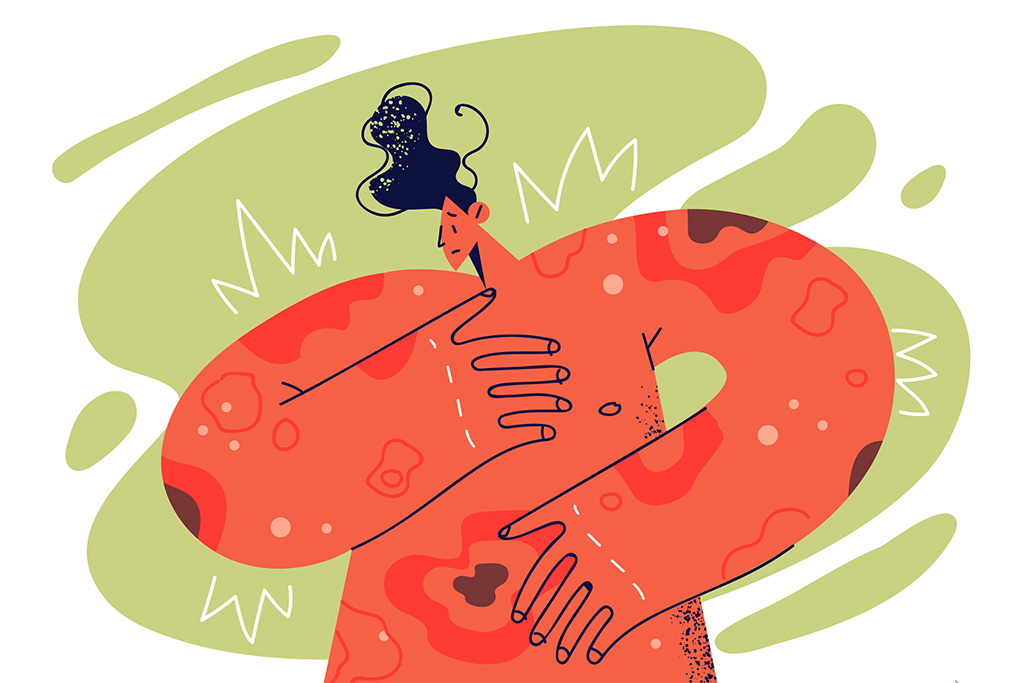 MMMnews's tweet image. Q&amp;amp;A: National Psoriasis Foundation CEO on the science of chronic skin disease mmm-online.com/home/channel/q… #Psoriasis #SkinDisease @NPF