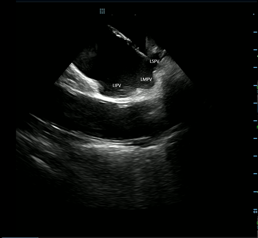 Jason Blohm tweet media