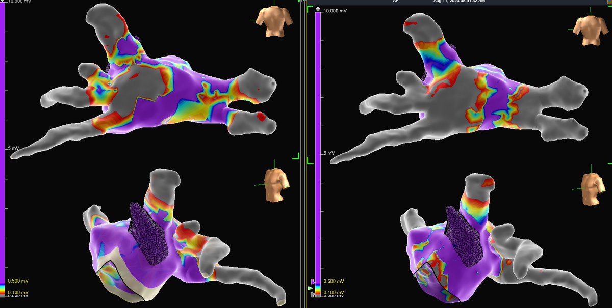 Jason Blohm tweet media