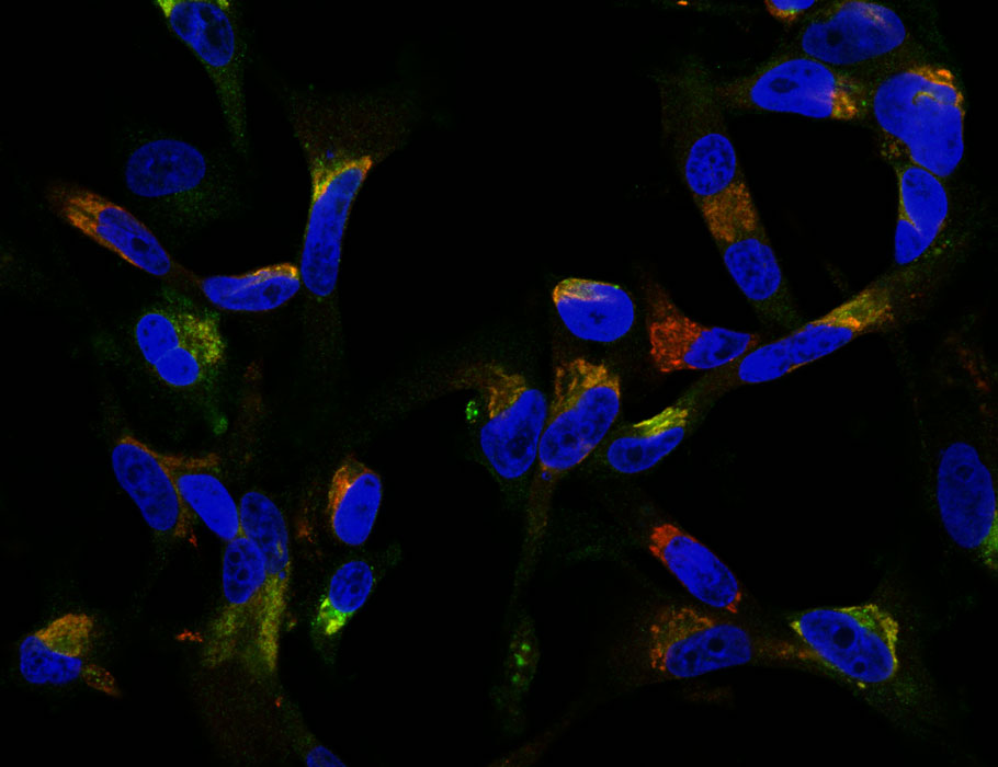 Science Signaling (@scisignal) on Twitter photo How does #HCMV trigger brain cancer growth?
Researchers find that US28—a receptor encoded by the HCMV genome—stimulates the sphingosine-1-phosphate pathway and mechanisms that support the proliferation and survival of #glioblastoma cells. <a href="/VUamsterdam/">Vrije Universiteit Amsterdam (inactief)</a> scim.ag/3L4 How does #HCMV trigger brain cancer growth?
Researchers find that US28—a receptor encoded by the HCMV genome—stimulates the sphingosine-1-phosphate pathway and mechanisms that support the proliferation and survival of #glioblastoma cells. <a href="/VUamsterdam/">Vrije Universiteit Amsterdam (inactief)</a> scim.ag/3L4