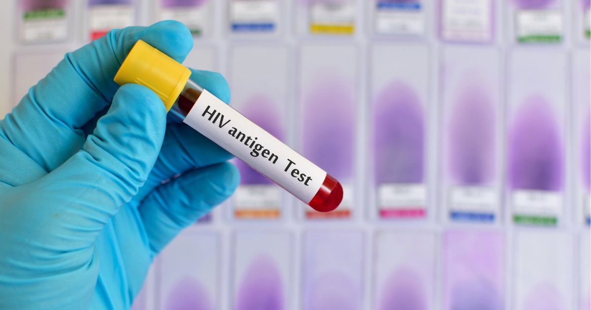 Pathology_RCPA's tweet image. HIV epidemiology in Australia has changed significantly. In the August issue of #Pathology, Williams et al @TheDohertyInst provide an update on laboratory detection and confirmation of HIV👇
#IDpath #HIV #medtwitter

 pathologyjournal.rcpa.edu.au/article/S0031-…