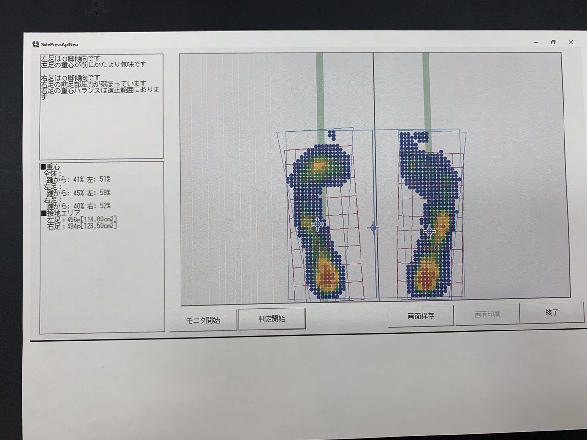 Ishii_Utunomiya's tweet image. 🦶🦶お盆限定、足型測定実施中🦶🦶

足裏の形だけでなく、力のかかり方の癖や重心のかかり方などを細かく分析！
登山だけでなく、普段の歩行に役立つデータが得られます✨

10秒乗るだけで測定可能！
無料なのでお気軽にどうぞ！

#石井スポーツヨドバシ宇都宮店
#SIDAS
#インソール
#ランニング