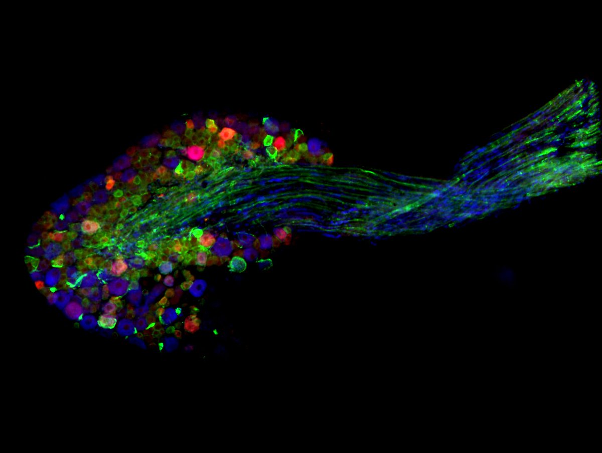HMRI Brain Neuromodulation Research Program (@newybrains) on Twitter photo Thursday #brainart!
The work of one of our talented Postdoctoral Researchers <a href="/IredaleJackie/">Jackie Iredale</a>
This image represents work undertaken to identify the different afferent nerve fibre types in the dorsal root ganglion (DRG) in order to determine what signals they would be transmitting. Thursday #brainart!
The work of one of our talented Postdoctoral Researchers <a href="/IredaleJackie/">Jackie Iredale</a>
This image represents work undertaken to identify the different afferent nerve fibre types in the dorsal root ganglion (DRG) in order to determine what signals they would be transmitting.