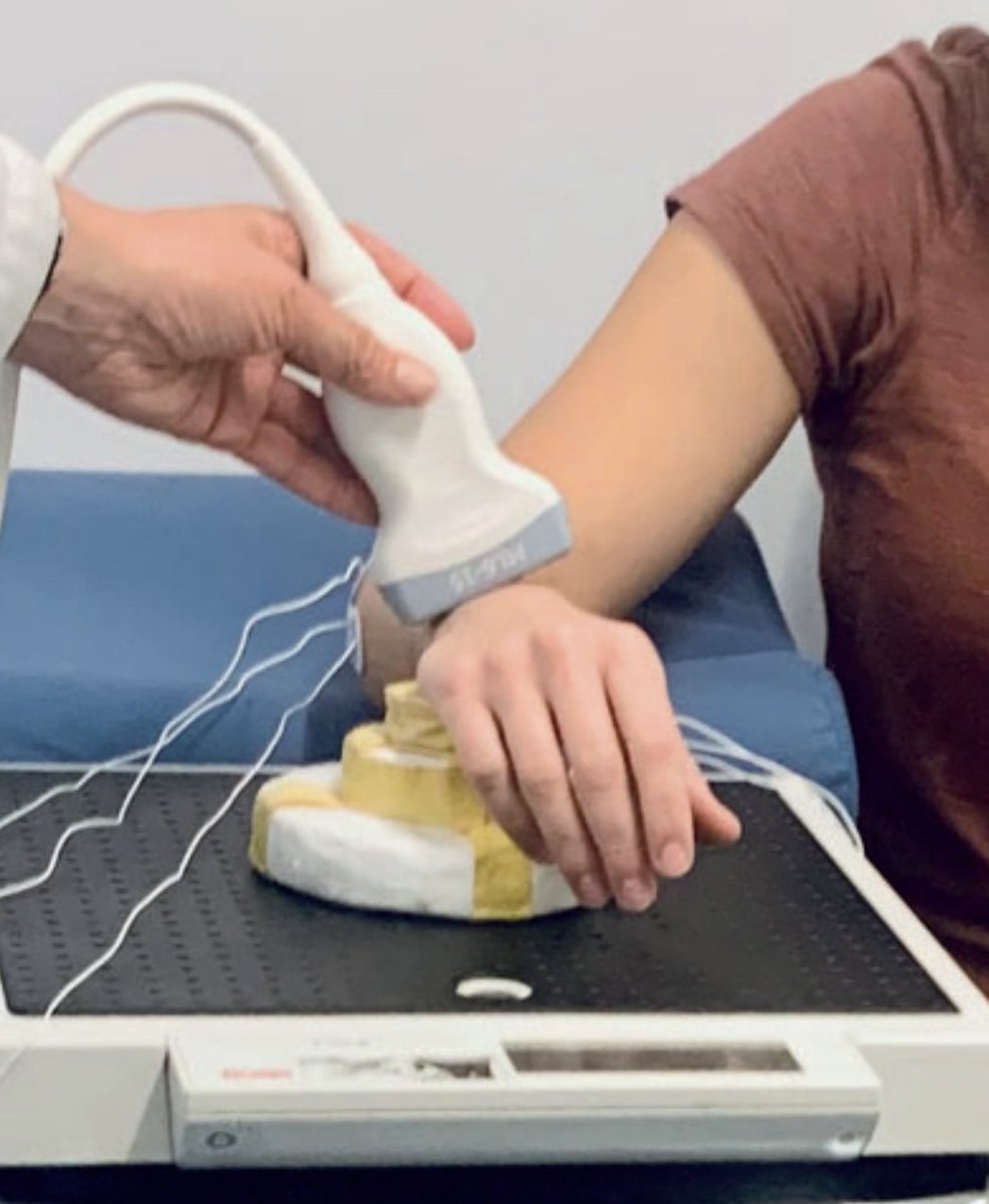 Rheumatology's tweet photo. Focus on the DRUJ

Stability of the distal radioulnar joint withand without activation of forearm muscles
https://t.co/MgRLD4E3La

The Role of Imaging in Diagnosing Diseases of the Distal Radioulnar Joint
https://t.co/rNcFH2fBDI https://t.co/aJ2OER7NVT