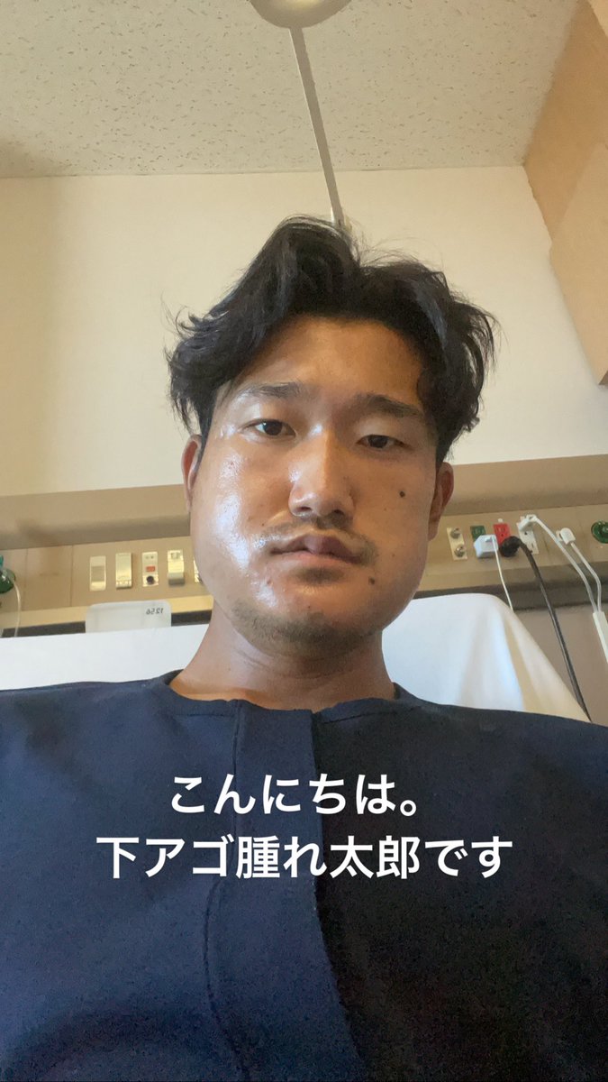 nishiyamataiga's tweet photo. 初めてアゴを骨折したんですがとんでもなく痛いんですね。術後の腫れも凄くてラフランスみたいになりました

まだ流動食が中心の食事しかできず辛い時間が続きますが、早く治して焼肉やお寿司とかを食べれるように頑張ります。じゃなくてチームに貢献できるように頑張りますアゴ https://t.co/F5yqV9TMxy
