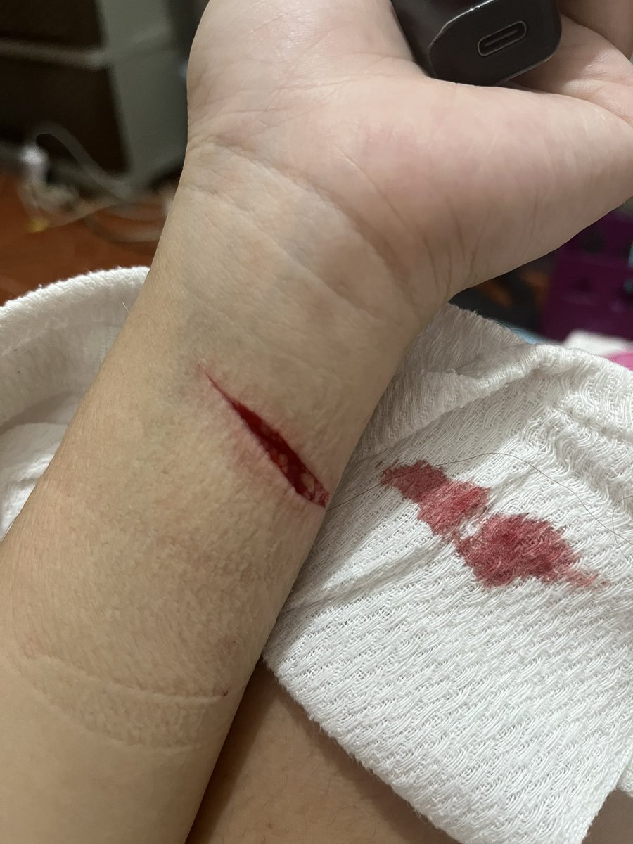 itsmejajam's tweet photo. People pushed me hard to harm my self. https://t.co/XYVrdAOaOM