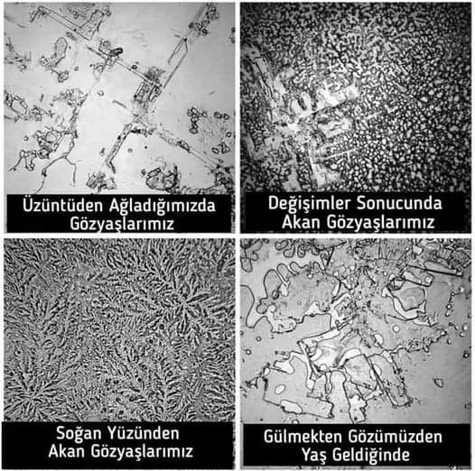 mx990007's tweet photo. Gözyaşlarına gülümse :)
Gözyaşları hep aynı değilmiş.
#gözyaşı
#Sevgi
#Hayat
#deprem
#suriyeliler
#SuperCup
#mutlukal https://t.co/MfcgI4l3ir