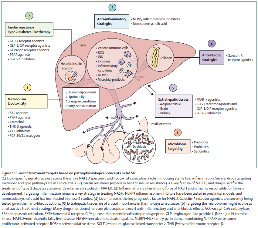 LancetGastroHep's tweet photo. New Review online — NASH drug treatment development: challenges and lessons, by Tilg, Byrne and Targher

A wide range of mechanisms are being studied; ideal #NASH candidates should be safe and  hepatoprotective+cardioprotective
https://t.co/QiwTPypNUf
#MASLD #MASH #LiverTwitter https://t.co/wKnEORh4gV
