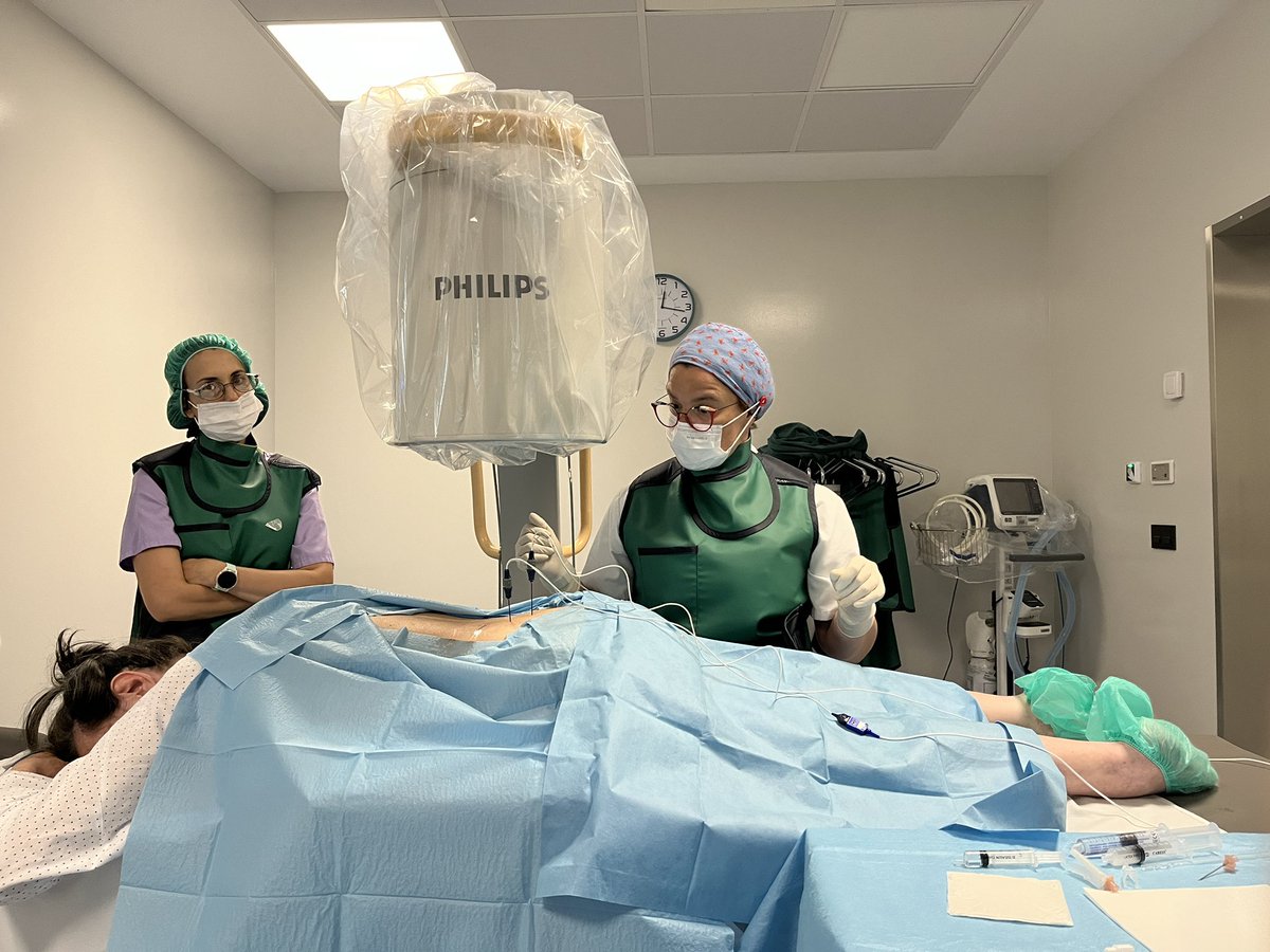 No paramos en Agosto! Hoy radiofrecuencia con grandes lesiones sobre ramo medio de la articulación facetaria con agujas Trident de <a href="/primneuromod/">PRIM Neuromodulación</a>