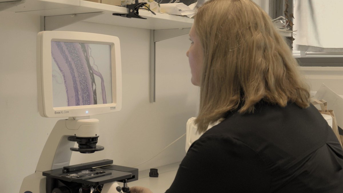 10ThingstoKnowAbout (@10things_toknow) on Twitter photo Age-related macular degeneration (AMD) is one of the leading causes of blindness in Ireland. In <a href="/10Things_ToKnow/">10ThingstoKnowAbout</a> About #AgeingWell <a href="/KathrionaDev/">Kathriona Devereux</a> meets <a href="/SDoyleTcd/">Sarah Doyle</a> & <a href="/mattcampbelltcd/">Matthew Campbell</a> to discuss research developing treatments for #AMD
<a href="/IrishResearch/">We are now Research Ireland</a> <a href="/tcddublin/">Trinity College Dublin</a>
#LoveIrishResearch Age-related macular degeneration (AMD) is one of the leading causes of blindness in Ireland. In <a href="/10Things_ToKnow/">10ThingstoKnowAbout</a> About #AgeingWell <a href="/KathrionaDev/">Kathriona Devereux</a> meets <a href="/SDoyleTcd/">Sarah Doyle</a> & <a href="/mattcampbelltcd/">Matthew Campbell</a> to discuss research developing treatments for #AMD
<a href="/IrishResearch/">We are now Research Ireland</a> <a href="/tcddublin/">Trinity College Dublin</a>
#LoveIrishResearch