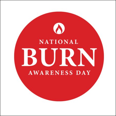 🔴 Preparations ongoing @uhbtrust for National Burn Awareness Day 🔴 #dateforthediary 11.10.2023 📝
It was great meeting Dave from @WMFSBournbrook yesterday 🚒👨🏻‍🚒 and hearing about the great prevention work they do in the community 😊 #beburnsaware
