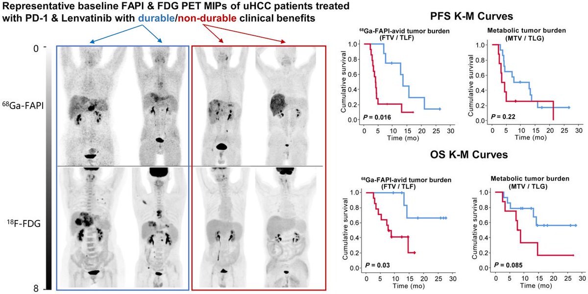 Can ⁶⁸Ga-FAPI serve as a predictive biomarker for unresectable hepatocellular carcinoma? ow.ly/qfr150PrNgo 

#NuclearMedicine #PETscan #HeptocellularCarcinoma