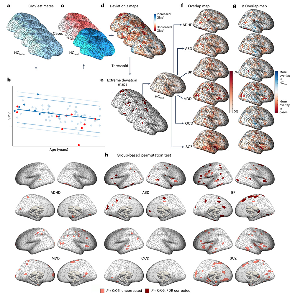 A new brain mapping approach reveals that volume changes in psychiatric illness occur in variable locations across individuals, but these differences often aggregate within common brain systems. The findings are published in @NatureNeuro. go.nature.com/45brxEd