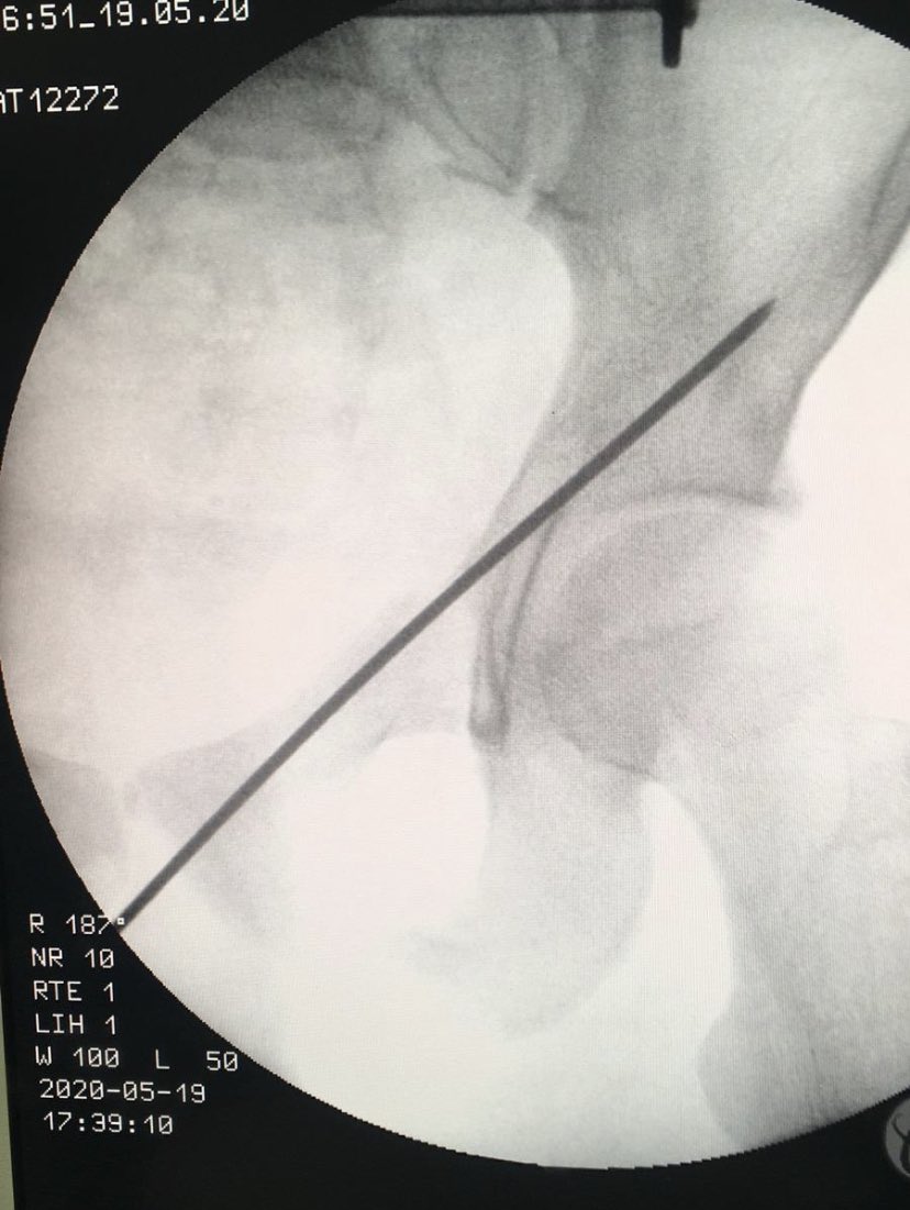 dr_haluk yaka tweet media