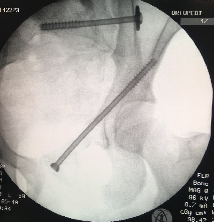 dr_haluk yaka tweet media