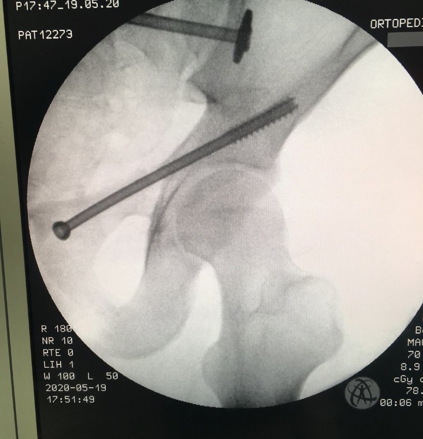 dr_haluk yaka tweet media