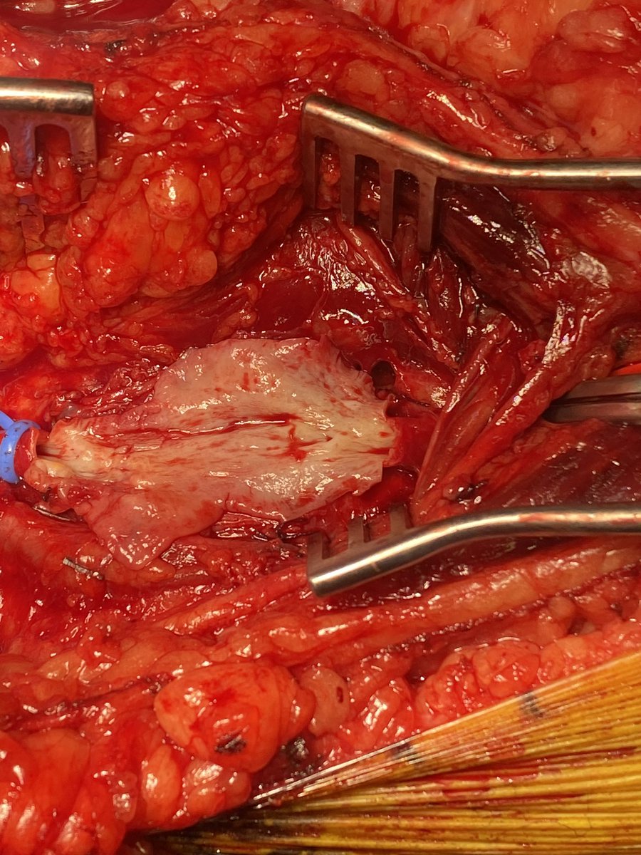 Shanka Benaragama tweet media