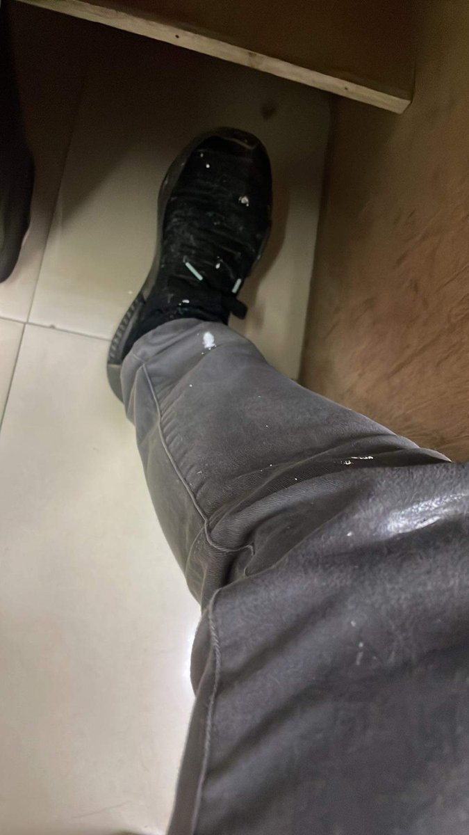 NikkoVillaroman's tweet photo. @2am ortho ER ☠️ https://t.co/IU2qGerv3R