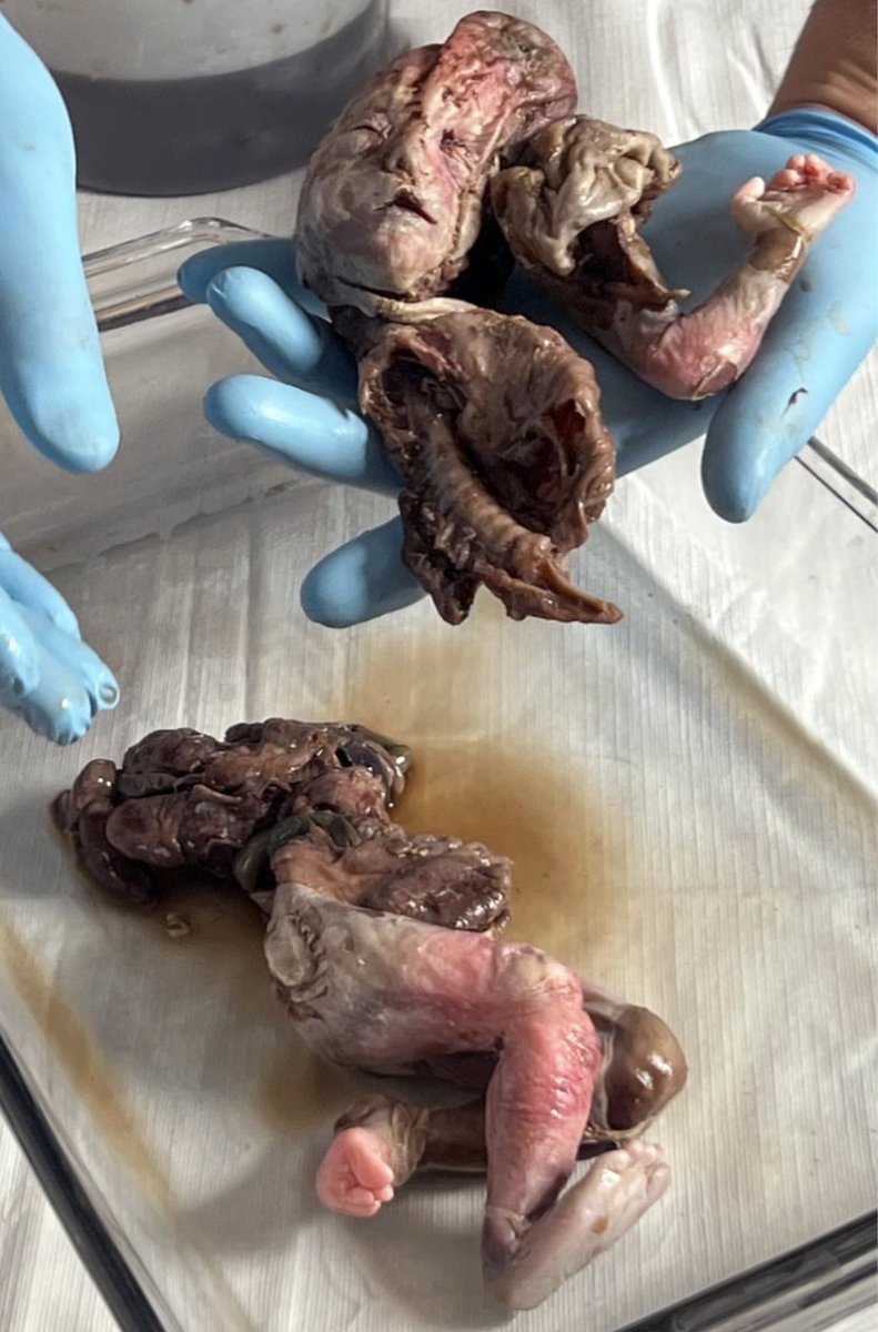 LilaGraceRose's tweet photo. @LiveAction In 2022, the same pro-life activists discovered 115 aborted babies in a bin outside of the same abortion facility.

Five were nearly full-term babies.

This is the “reproductive health care” that these pro-life activists were obstructing. https://t.co/2Uy4HTvYtE