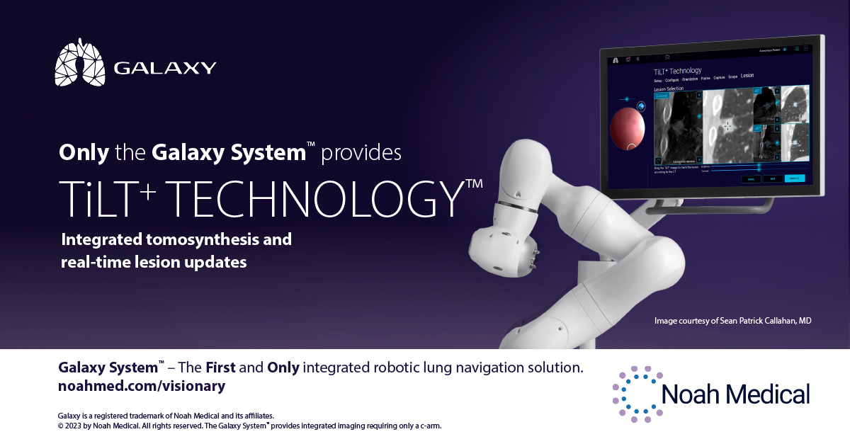 NoahMedical's tweet photo. The Galaxy System™ with TiLT+ Technology is the First and Only lung navigation solution to provide Integrated Tomosynthesis and Tool-in-Lesion Confirmation. Visit https://t.co/TGGlUuRdsQ to learn more! #FirstandOnly #GalaxySystem #NoahMedical #LungCancer https://t.co/W9Gjxljwtn