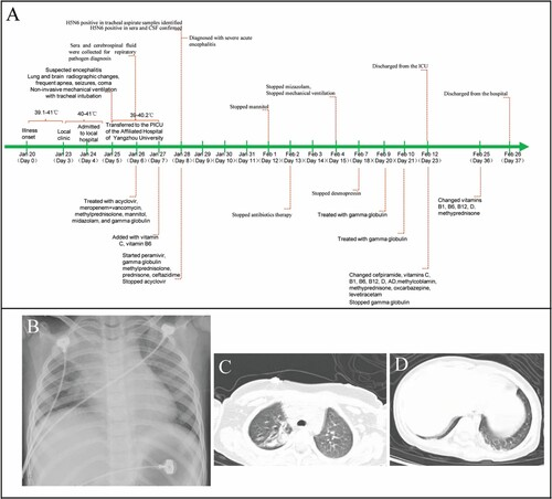 Acute encephalitis with mild pneumonia in a child in China caused by the H5N6 virus. HPAI found in patient’s serum, CSF, and tracheal aspirate specimens. Virus similar virus in human infection and in ducks in China.
👉tandfonline.com/doi/full/10.10…