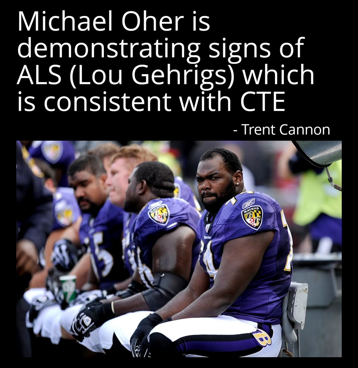 TheNews4Dummies's tweet photo. After reading the back and forth about @MichaelOher and the Tuohy Family im- I believe Oher is displaying signs of CTE.
His behavior & stories are a bit irrational.
#tuohy #oher #Blindside https://t.co/zQee84pJYQ