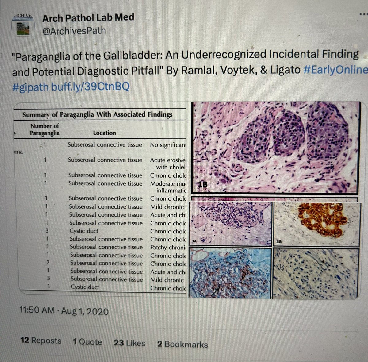 This paper is a great utilization of tens of thousands of freely available annotated #Pathology images that #PathTwitter (or #PathX) has put online over the years on this platform. The training set includes 1000s of images from each subspecialty, including &gt;15,000 images in
