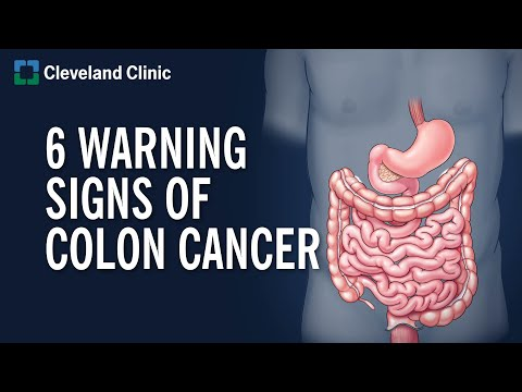 stkirsch's tweet photo. On a recorded Twitter space I just did (Kirsch vs. Real Truther) someone told the story of a PharmD who post-vaccine treated 60 colon cancer patients who were <25 years old. All were vaccinated.

Stats prior to COVID vax: Never seen a single case before in the 30 years he's been on the job of someone that young with colon cancer.

Do you think MAYBE the vaccine may be causing this?