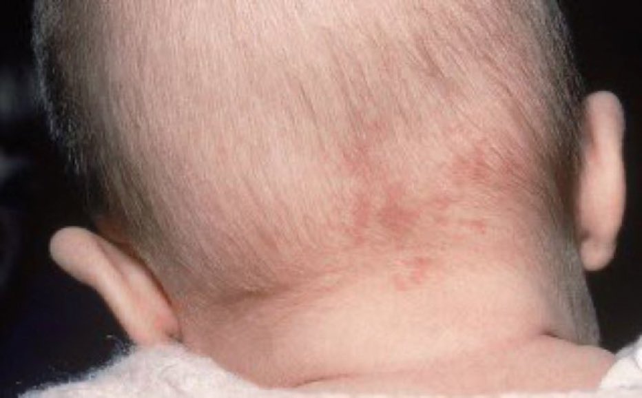 Kevin Burns (@burnskevd) on Twitter photo 