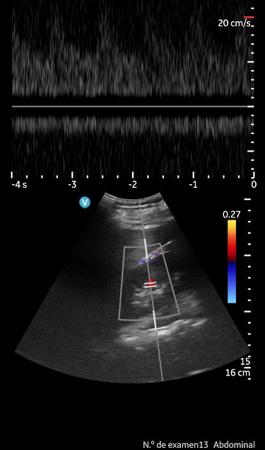 Yale Tung-Chen tweet media