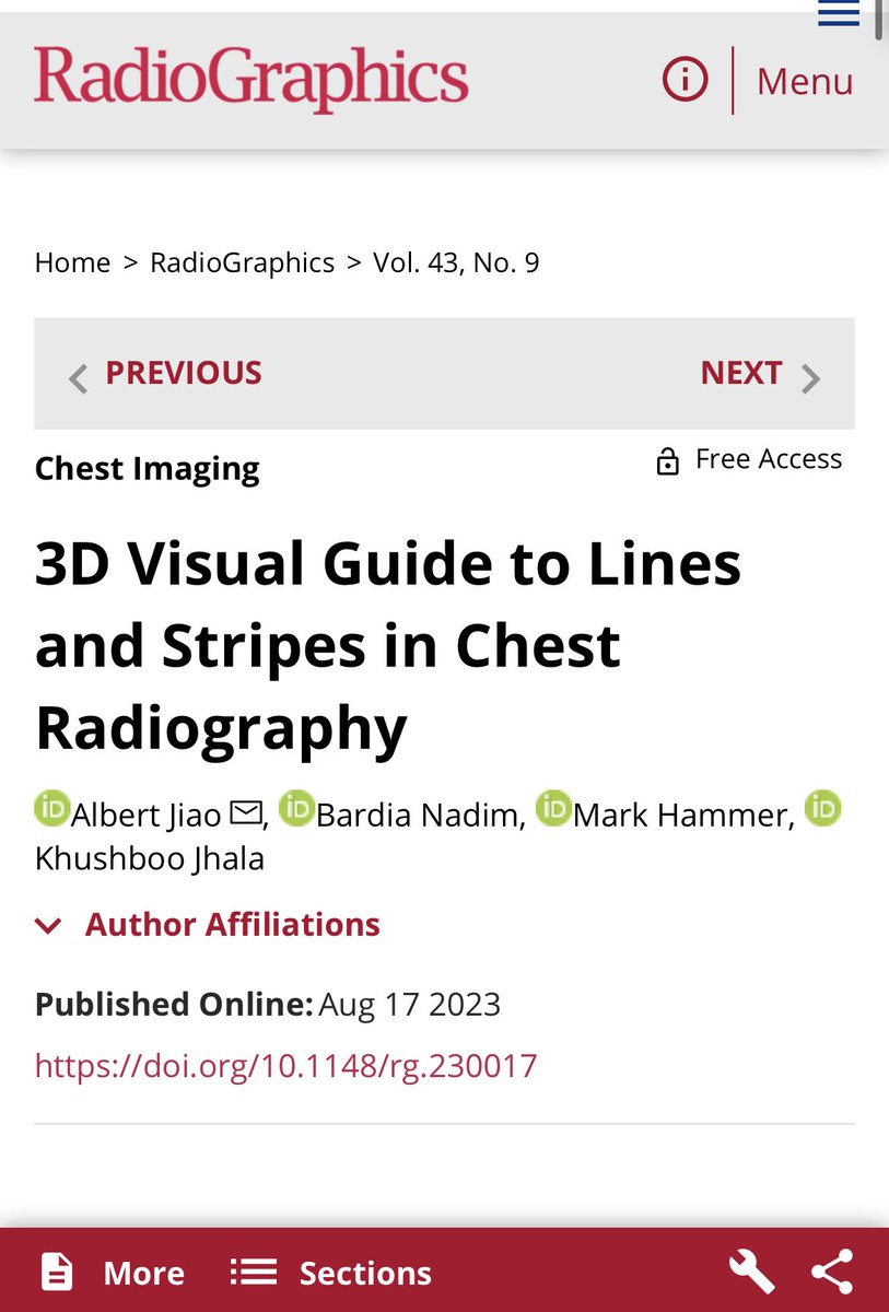 Our Radiographics paper on Lines and Stripes has been published! Check it out!