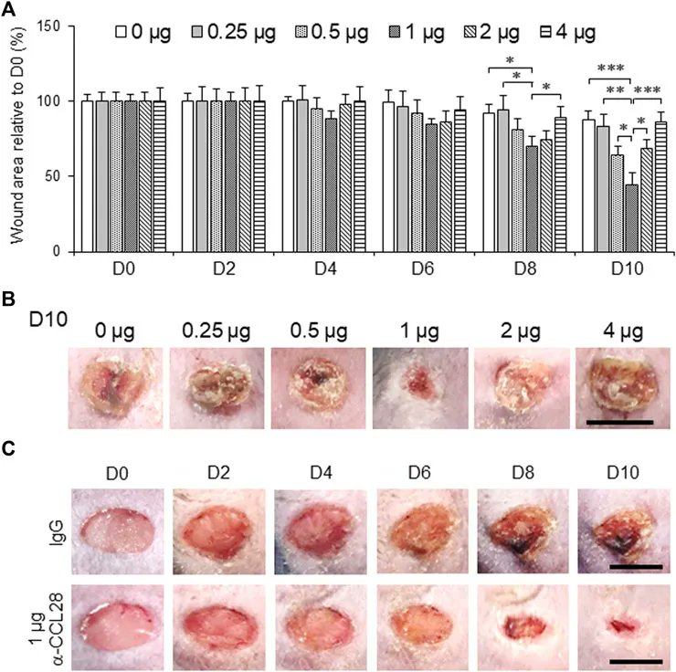 Neutralization of excessive CCL28 improves wound healing in diabetic mice 
buff.ly/3YcICJN