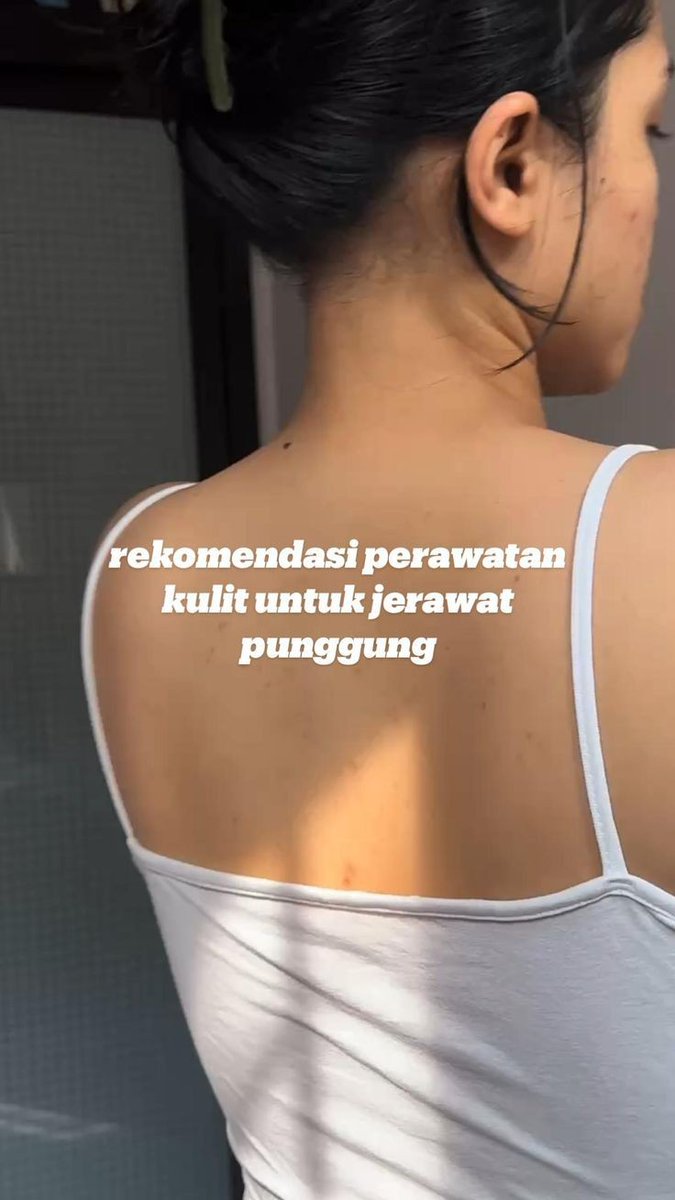 rrandomlyyyy's tweet photo. Treatment Bebas Jerawat Badan!

Punggung, lengan, leher belakang, dada.

- A Thread - https://t.co/e45mGIEvJh