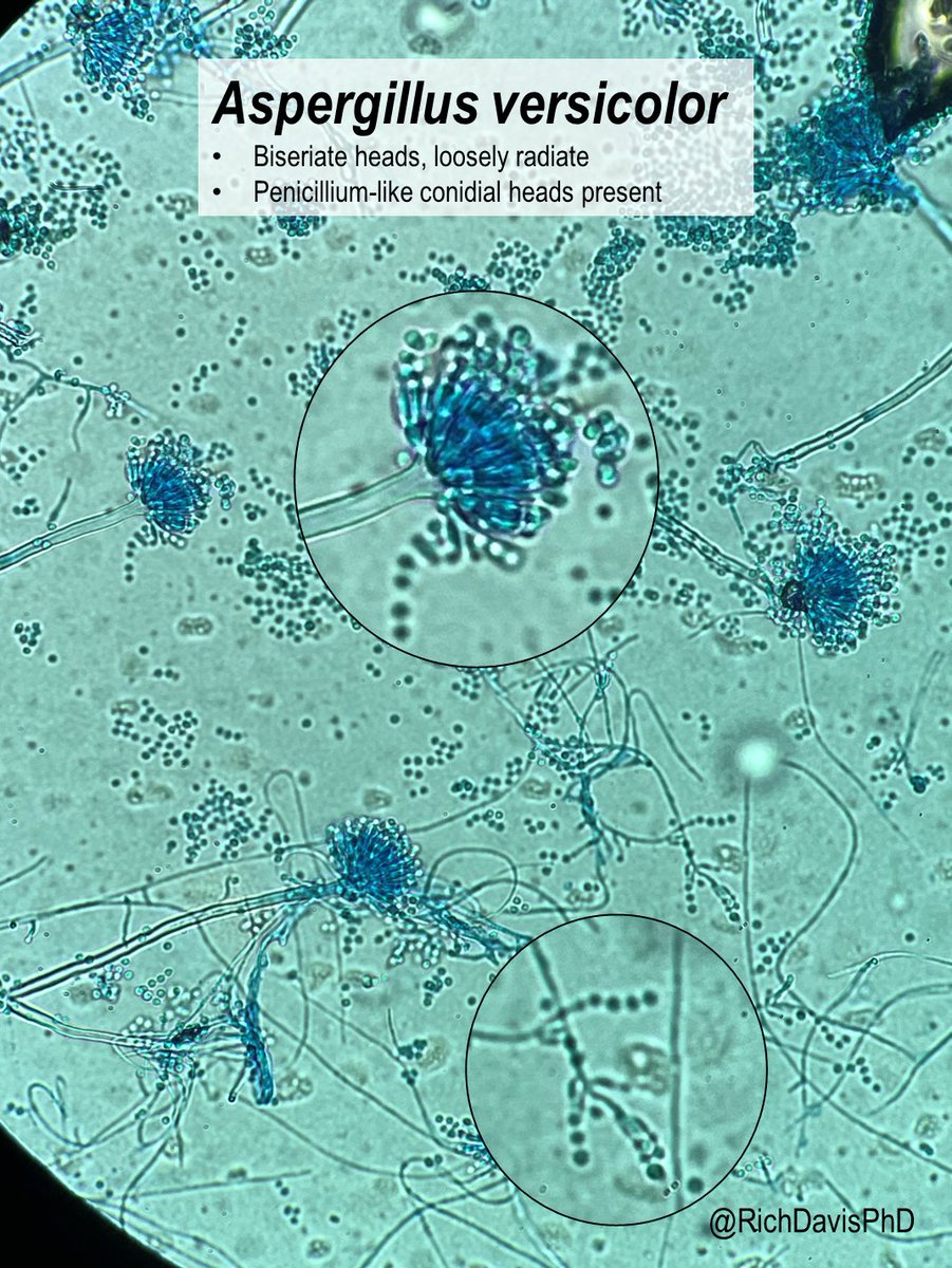 #MicroRounds (Day 993): 'color me impressed' #FungalFriday A fantastic isolate of Aspergillus versicolor, w/ beautiful yellow-suede, green peak colonies. Along w/ loose, biseriate heads, seeing Penicillium-like heads is completely normal for this species #ASMClinMicro #IDTwitter