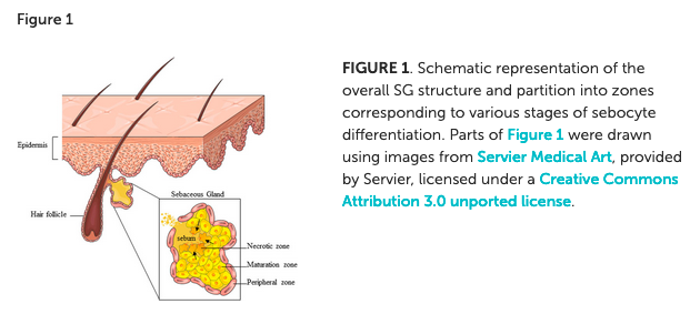 HealthyFellow's tweet photo. #Insulin &amp; #sebaceous gland function 

https://t.co/1N9VZzrvvt 

@_atanas_ @_INPST @ScienceCommuni2 @DHPSP @mindzatwork @REV_Insulin_Res @markeatsmeat @InsulinResistRN @shashiiyengar @saaiyer @skinhealthall @kojija @LoriShemek @LowCarbRD https://t.co/203UIQYKyD
