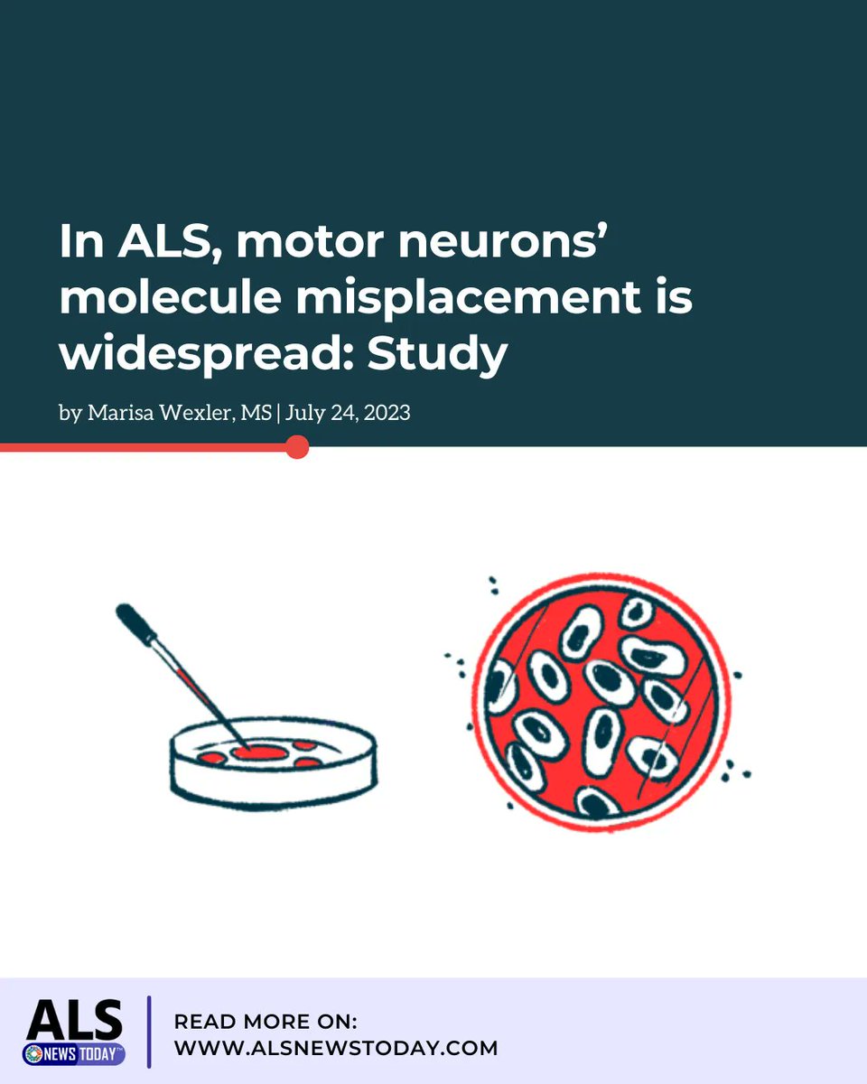 alsnewstoday's tweet photo. Findings from earlier this summer support the idea that, in ALS, transport issues such as misplaced proteins exist within cells. https://t.co/kVHGQmbggL
#amyotrophiclateralsclerosis #alsprogression #alsmanagement #alsresearch https://t.co/YiDtVxDq2P