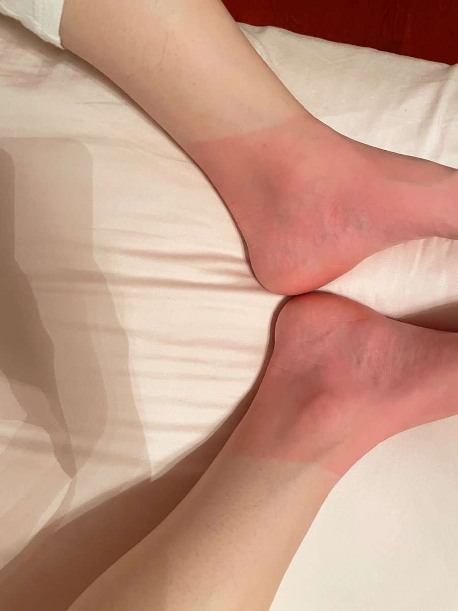 Kerr19880403's tweet photo. 当你的脚，被你的鞋，磨出了泡，你却还舍不得丢掉，那说明你喜欢，突然有一天这个泡，让你日夜疼痛，你才会发现，这样的坚持，是多么的不值得。因为这双鞋，从没心疼过你的脚。所以，善良要遇对人，付出要对值得的人。 https://t.co/07Z1PA6Bgp