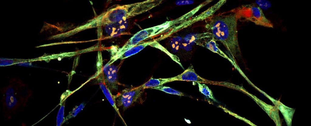 Aggressive cancer cells transformed into healthy cells in science breakthrough. 👏

#CancerCells #HealthyCells #Cells #CellBiology #Cancer #Medicine #Science 

sciencealert.com/aggressive-can… via @ScienceAlert