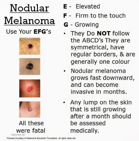 Nodular #melanoma. Know the facts.