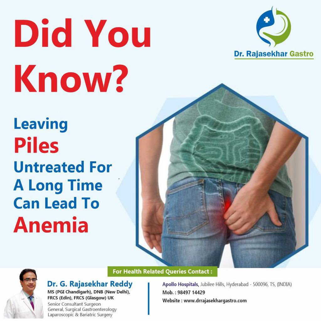 Did you know?

Leaving piles untreated for a long time can lead to anemia 

#piles #pilestreatment #pilescare #hyderabad #gallbladder #gallbladdersurgery #gallbladderremoval #gallbladderproblems #herniasurgery #hernia #weightlossgoals #cholecystectomy #gallstones #hyderabadi