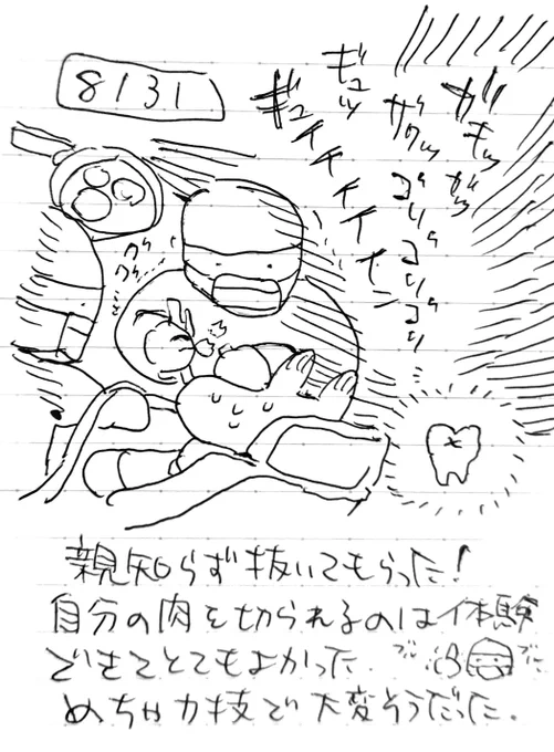 親知らず抜歯日記🦷 