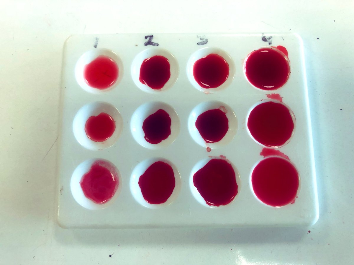 OHara_Biology's tweet photo. 2T were investigating which blood groups are compatible and which coagulate (form clumps) when combined. Great work and we will discuss the results and findings next lesson! 🩸 🩸 @amygoo27 #S2superstars #blood #biology #topicalscience https://t.co/yyz263iPZY