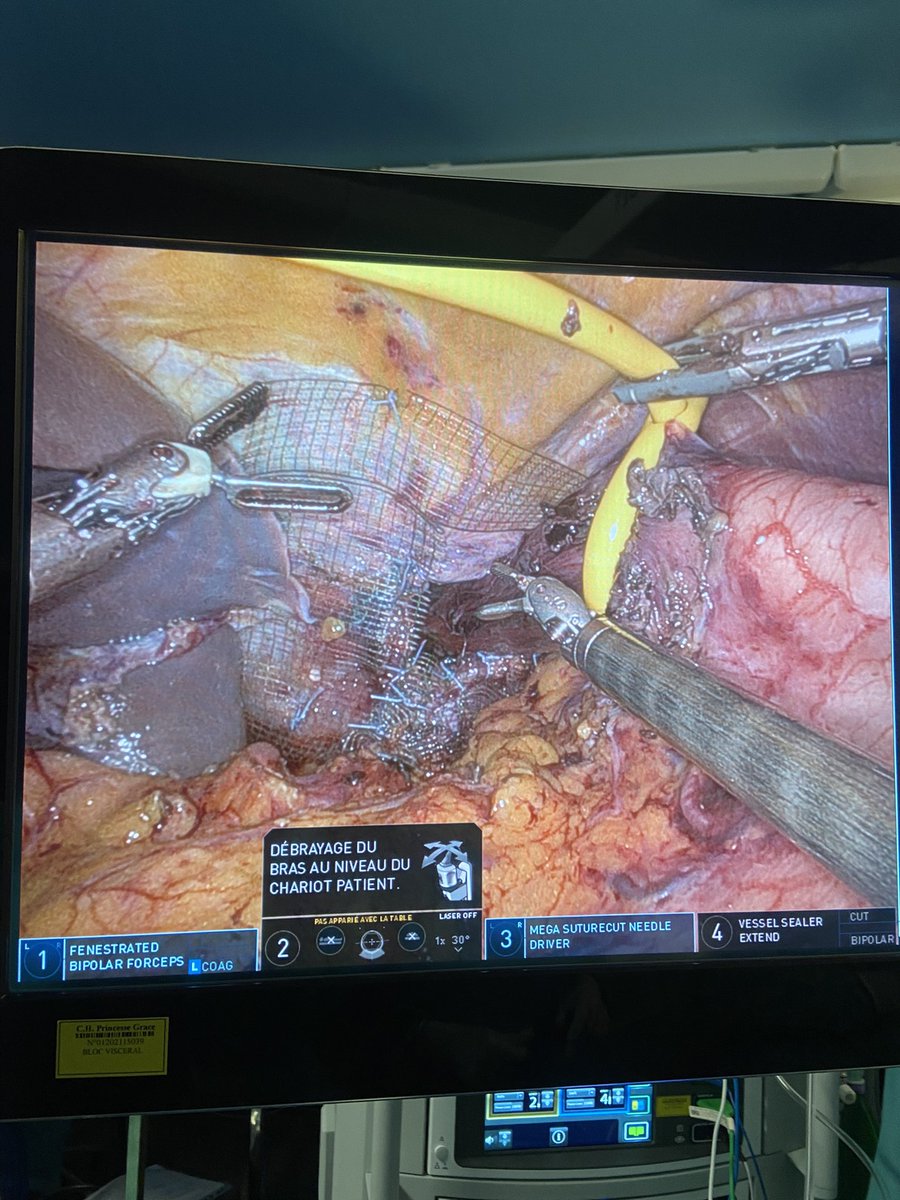 Temimevic's tweet photo. Robotic hiatal hernia #CHUnice https://t.co/hfQRKc7922