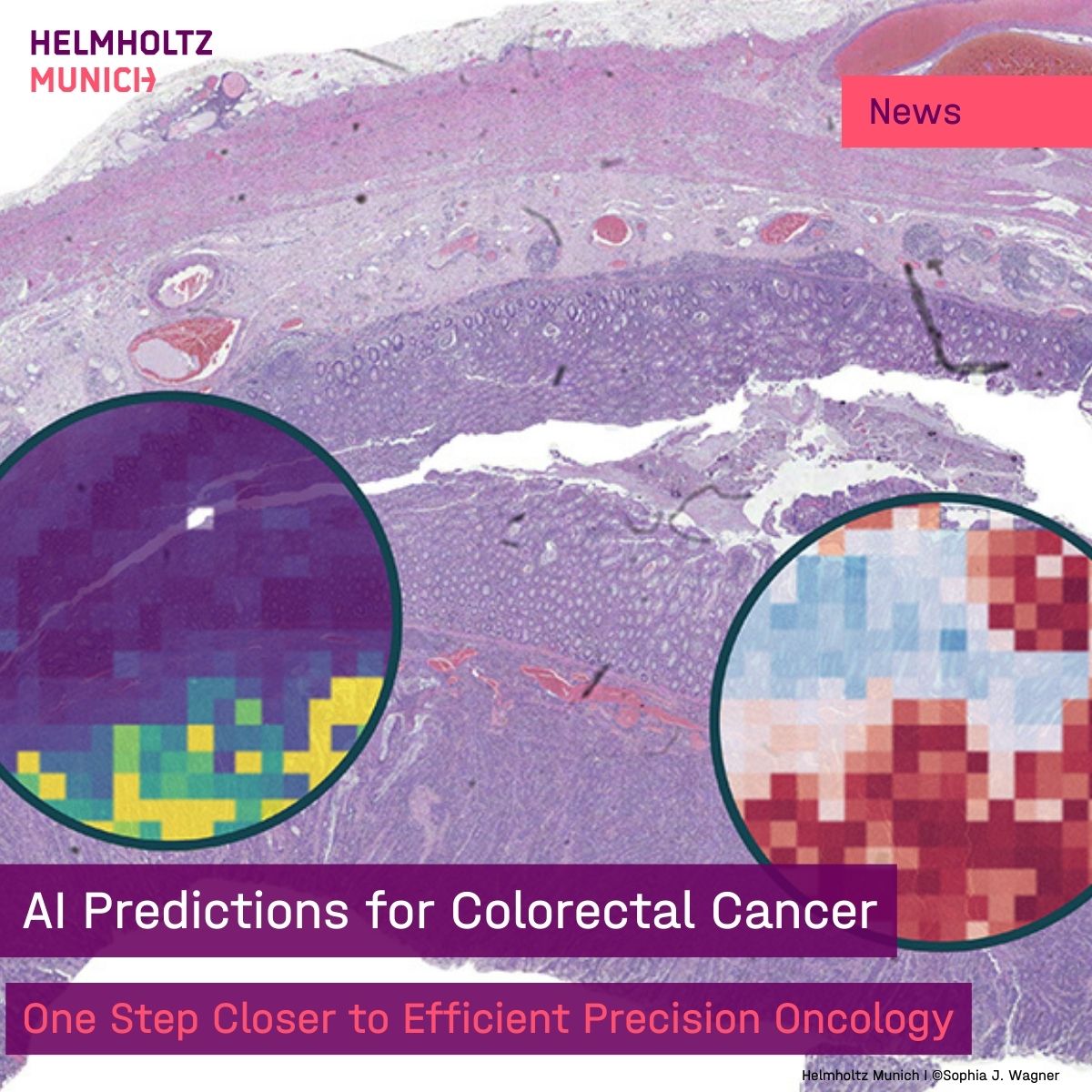 📝Hope for Colorectal #Cancer Using #AI, scientists from #HelmholtzMunich & TU Dresden boost #precision #medicine in #oncology: Novel model for #biomarker detection helps to analyze tissue quicker, speeding up treatment decisions. 👉more insights: t1p.de/pmcs0 @jnkath