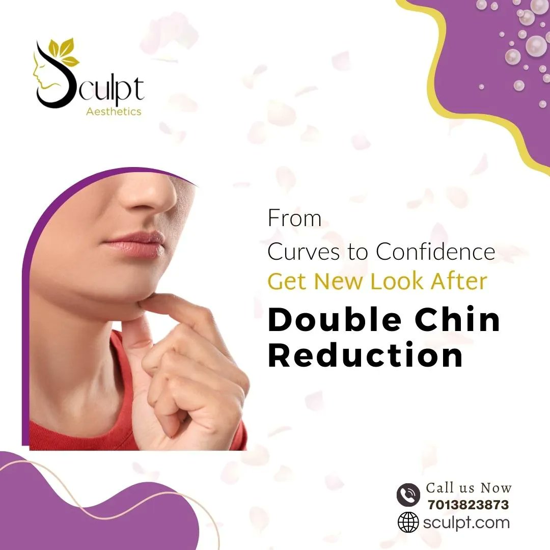 'Every step forward is a victory. Here's to a more sculpted, confident version of me.' 
Lifestyle Changes: 
#DoubleChinReduction
#ChinUp
#JourneyToConfidence
#SculptedProfile
#SelfImprovement 
call/whatsapp:7013823873