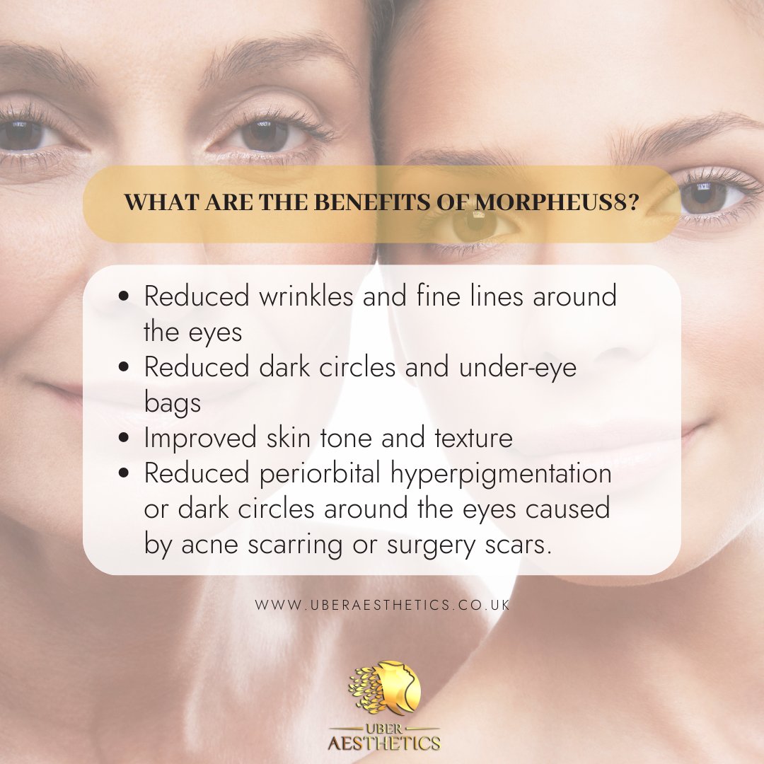 Uberaesthetics1's tweet photo. Morpheus8 is a minimally invasive skin rejuvenation procedure that pairs microneedling with radiofrequency (RF) energy.
#Aqualyx #prphairloss #8pointfacelift #Jawfiller
#cheekfiller #nonsurgicalbrazilianbuttlift #hyderafacial
#bumlift #lasergenesis #Botox #hairremoval
#cheshire https://t.co/7mJJjf1aau