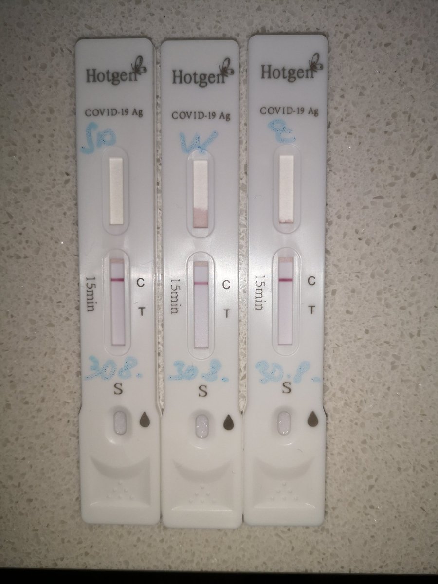 FBergmann_VT's tweet photo. Dann #Hotgen: Hier gibt es ein negatives Ergebnis für Spucke, Wange & Zunge bei gleicher Beprobung wie zuvor beim #Longsee. Werde letzteren mit abnehmender Viruslast erneut mit Spucke testen. https://t.co/117NGRCX9J
