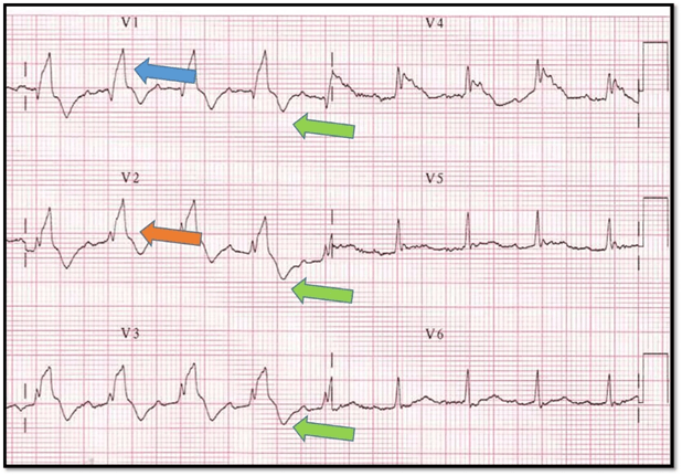 CardioTeca tweet media