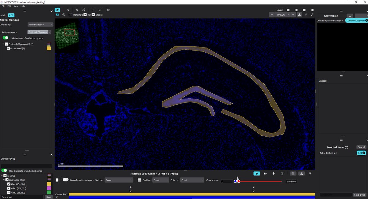 vizgen_inc's tweet photo. The #MERSCOPEVizualizer makes it easy access your #MERFISH #SpatialData & uncover biological insights with #SingleCell #GeneExpression analysis.
Learn more today: https://t.co/1Hdy6tNP3F
#MERSCOPE #SpatialAnalysis #UMAP #Heatmap #CellSegmentation #SpatialProfiling #DataAnalysis https://t.co/FXUHemLZAJ